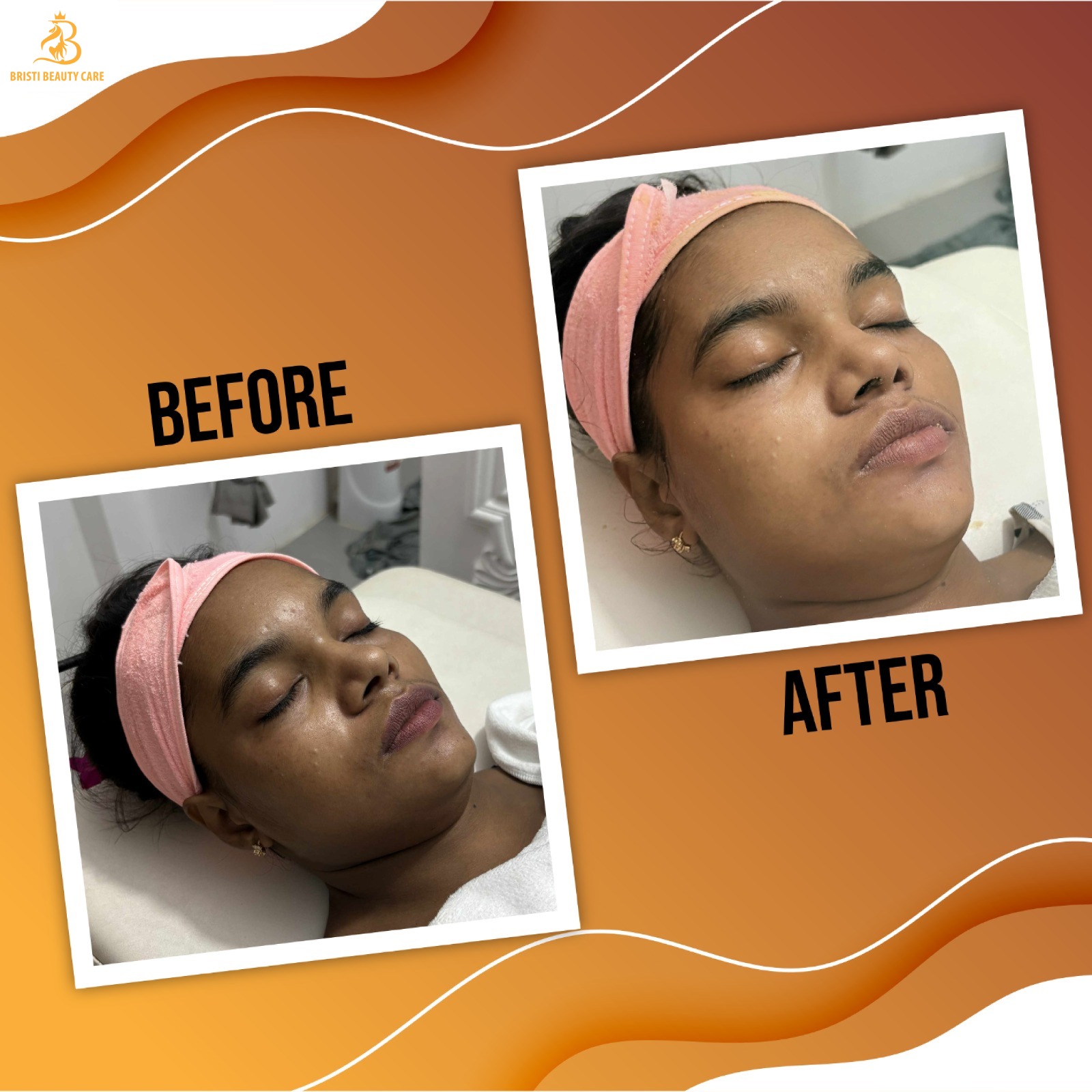 WhatsApp Image 2025-06-24 at 9.32.45 PM